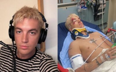 Paul Klein, da banda LANY, é hospitalizado após ser atropelado por um carro